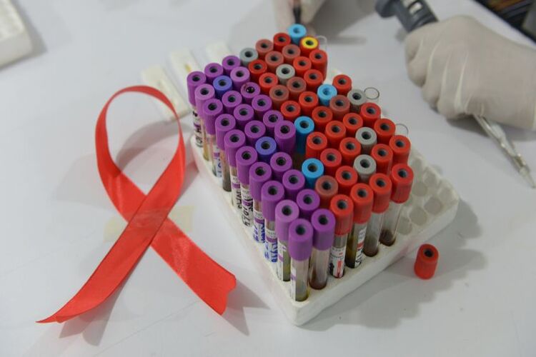 ผู้สมัครรับวัคซีนเอชไอวีกระตุ้นการตอบสนองทางภูมิคุ้มกันในการทดลองทางคลินิกระยะแรก: ‘ก้าวสำคัญ’